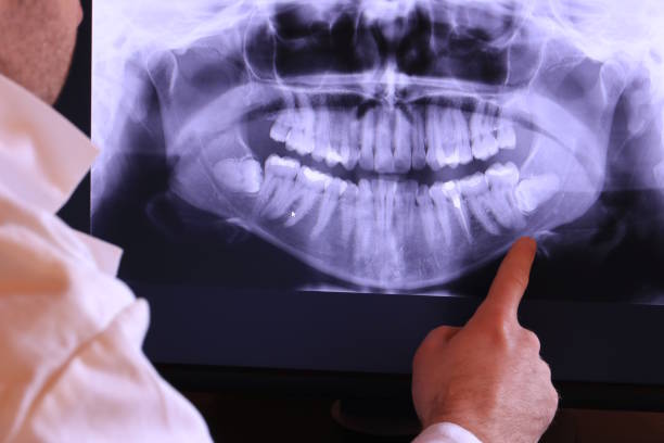 Best Emergency Broken Tooth Repair in Rkesburg, PA